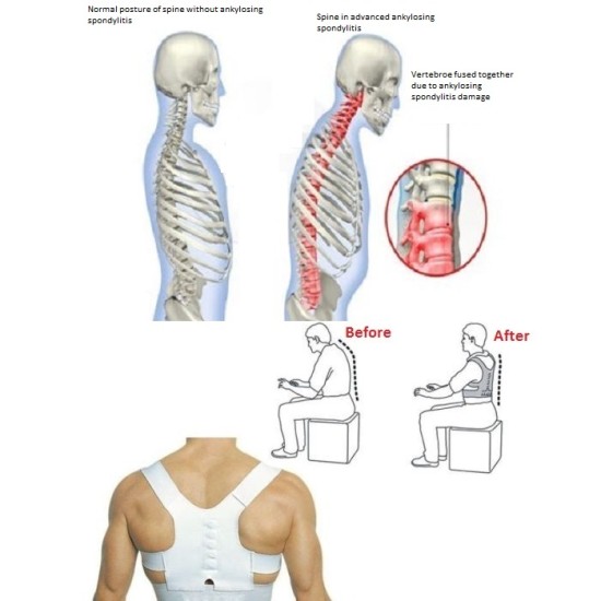 Μαγνητική Ζώνη Στήριξης Πλάτης - Power Magnetic Posture Sport Μαγνητική Ζώνη Στήριξης Πλάτης - Power Magnetic Posture Sport