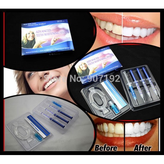 5Packs/lot Advanced Teeth Whitening System Teeth Whitening Home Kit MY315 5Packs/lot Advanced Teeth Whitening System Teeth Whitening Home Kit MY315